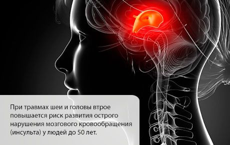 Імовірність інсульту підвищується в перші місяці після травми голови або шиї