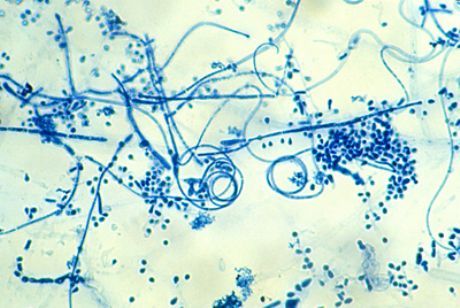 Збудник епідермофітії стоп (Trichophyton interdigitale)