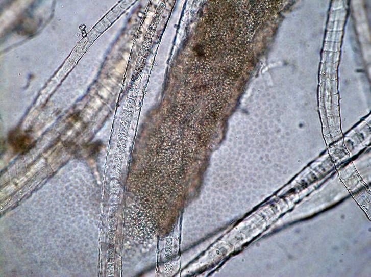 Нити мицелия споры. Trichophyton микроскопия. Микроспория и трихофития. Микроскопия Trichophyton verrucosum. Поверхностная трихофития микроскопия.