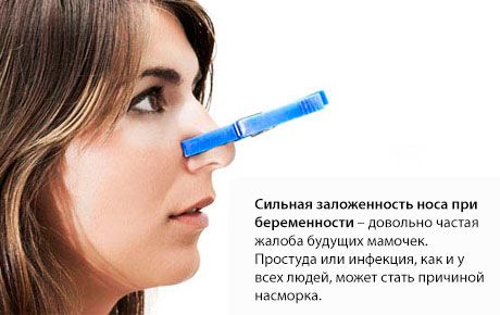 Закладеність носа при вагітності